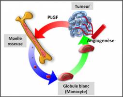 Cancer du sein : nouveau proc�d� de diagnostique