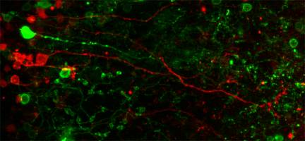 Das Gehirn der Fruchtfliege kann sich selber reparieren
