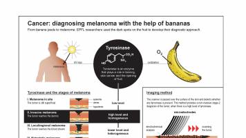 Cancer: banana peels can help identify the stages of melanoma