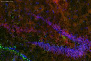 Ein neuer Ansatz zur Bek�mpfung von Angstzust�nden, Schmerzen und Entz�ndungen