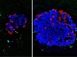 Découverte d'une des clés du diabète sucré