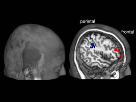 Der Drang nach Entscheidungsfreiheit ist im Gehirn messbar