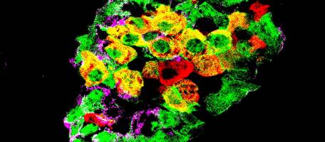 Des cellules changent de m�tier pour contrer le diab�te