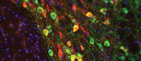 Des synapses à l'origine de troubles autistiques