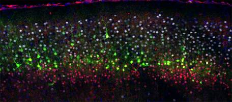 Le courant électrique, étincelle de la diversité cellulaire du cerveau