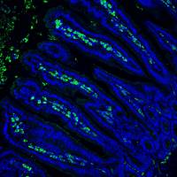 Neuer Schutzmechanismus des Darms entdeckt
