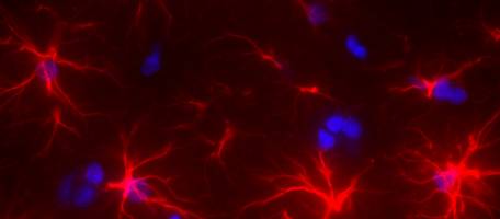 Quand le foie malade d�r�gle le cerveau