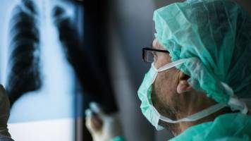 Artificial lung helps investigate how COVID-19 causes blood clots