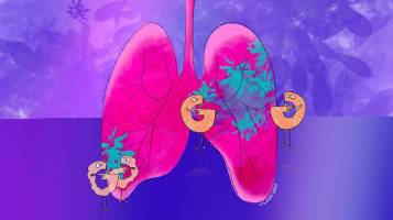 Blocking sugar metabolism slows lung tumour growth