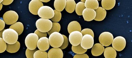 La frilosit� des staphylocoques r�v�le un point faible