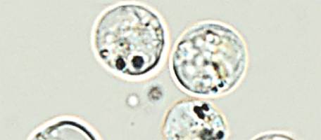 Les nanoparticules perturbent les algues