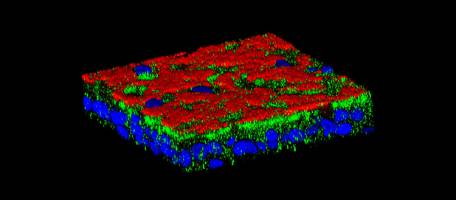 Mucoviscidose: pourquoi autant de complications respiratoires?