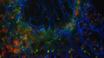 Multicolor super-resolution imaging made easy