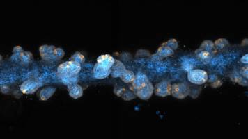 Researchers develop new method to print tiny, functional organs