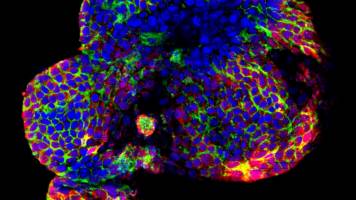 Transplantable lab-grown organs move a step closer