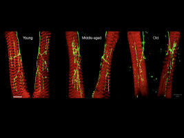 Brain 'noise' keeps nerve connections young