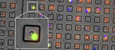 Cancer: a new killer lymphocyte enters the ring