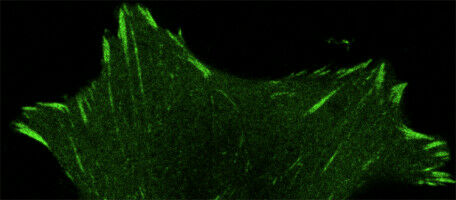 Cells rely on their crampons to avoid slipping