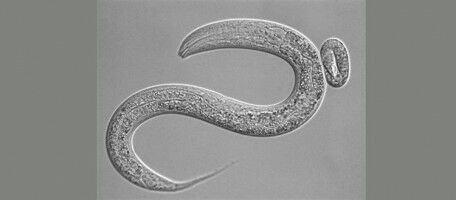 Comment l'alimentation contrôle la maturation des ARN