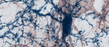 R�parer les synapses pour combattre la scl�rose en plaques