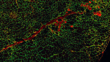 Urolithin A shows effective against muscular dystrophy