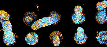 Des tornades de cellules sculptent nos organes