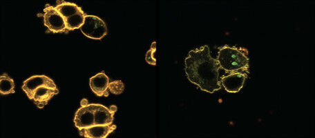 Diabetes: when circadian lipid rhythms go wrong