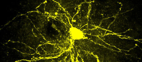 Gene-environment interactions that drives autism