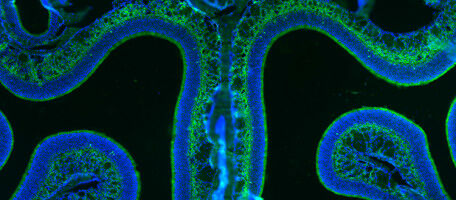 I neuroni olfattivi si adattano all'ambiente circostante
