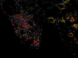 The Right Environment for Fighting Cancer