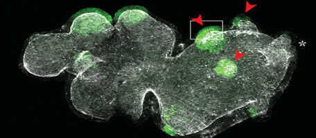 Comment transformer un tentacule en pied