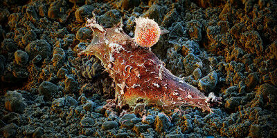 Pour que les globules blancs ne souffrent pas de burn-out