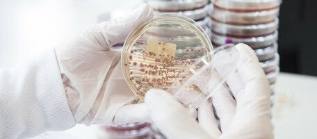 Antibiotic resistance: concerning situation in sub-Saharan African children