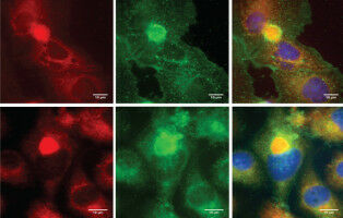 Scoprire i segreti del virus 'uncoating' pu� aiutare a combattere le infezioni