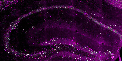 Le cerveau stocke un souvenir en trois copies