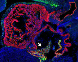 �Genw�ste� steuert Embryonalentwicklung und Herzfunktion