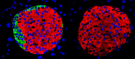 Insulin cells don't need to team up