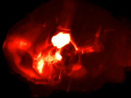 La sérotonine pour rebondir face à l'adversité