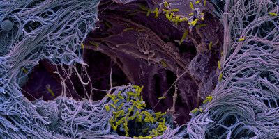 Mini-Lungen enthüllen Rätsel: So infizieren Krankheitserreger die Lunge