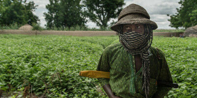 Noma : donner un visage à une maladie mortelle