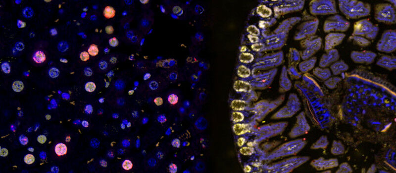 Rot, links, sind Leberzellen, deren DNA geschädigt ist. Gelb gefärbt sind rechts