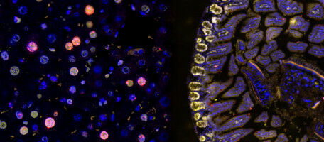 Warum manche Organe schneller altern als andere