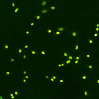 Wie Zellen ihren Proteinspiegel ausgleichen