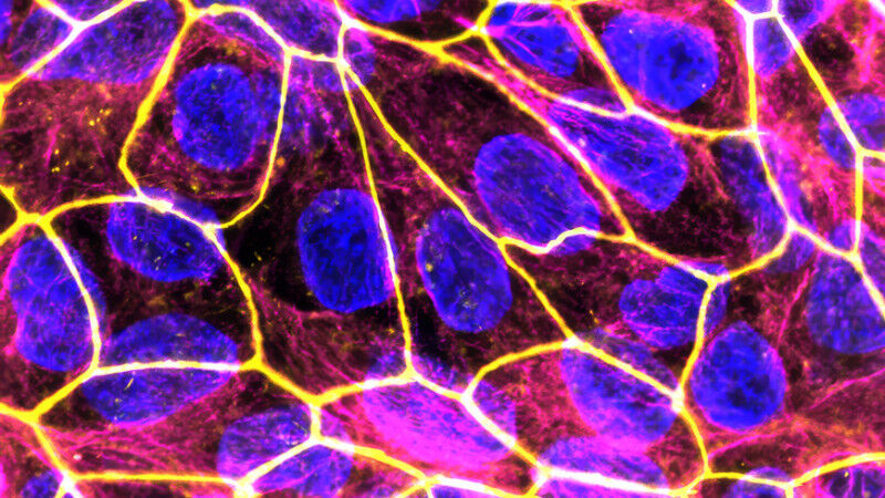 Les nouveaux nanomédicaments pour le traitement des processus inflammatoires pen