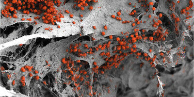 I ricercatori costruiscono un modello umano completo di midollo osseo