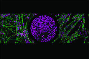 Come le cellule scelgono di diventare muscoli o neuroni