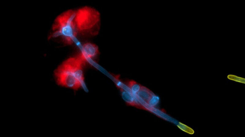 The yeast fungus Candida albicans (blue) breaks out of human immune cells (red)