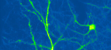 Le cerveau ajuste nos perceptions en temps réel
