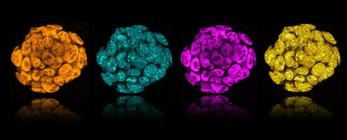 New Protein Targets for Cancer Treatments