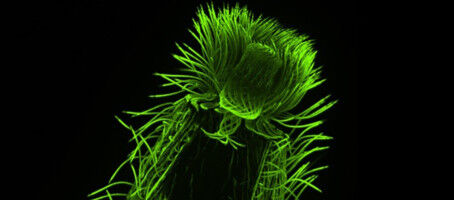 Rivelare l'architettura cellulare nascosta del plancton